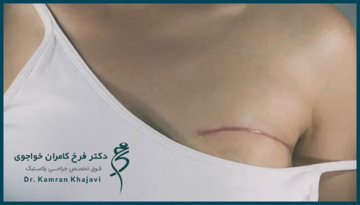 نکات مهم مراقبتی بعد از ترمیم سینه