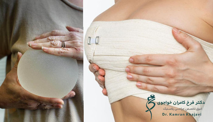 مراحل عمل همزمان لیفت و پروتز سینه