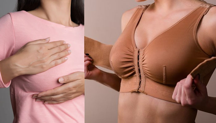 پوشیدن سوتین طبی بعد عمل پروتز سینه