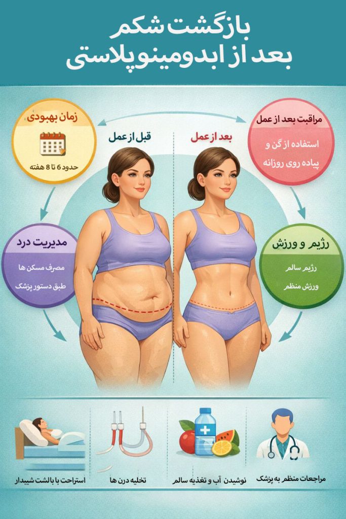 جلوگیری از بازگشت شکم بعد از ابدومینوپلاستی