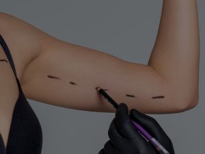 رنوویون بازو - دکتر فرخ کامران خواجوی