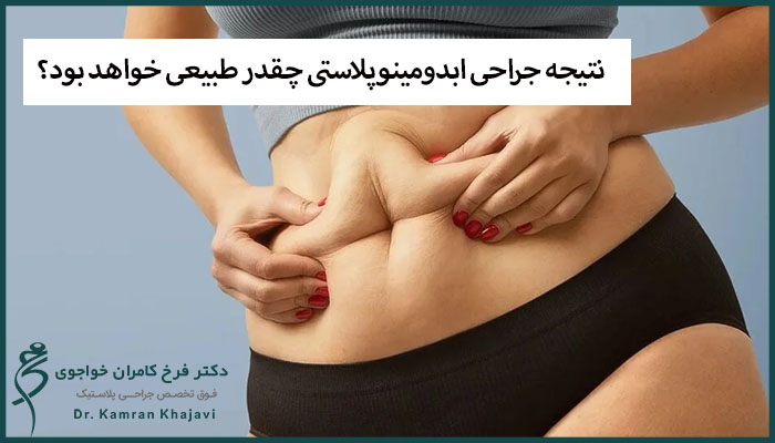 نتیجه جراحی ابدومینوپلاستی چقدر طبیعی خواهد بود؟