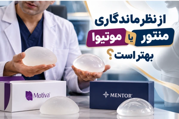 از نظر ماندگاری منتور بهتر است یا موتیوا؟
