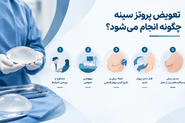 تعویض پروتز سینه چگونه انجام می‌شود؟