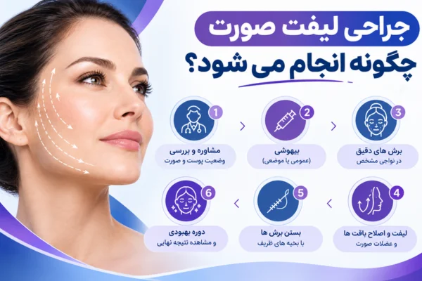 جراحی لیفت صورت چگونه انجام می شود؟